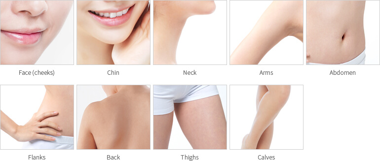 Areas of application for Liposuction