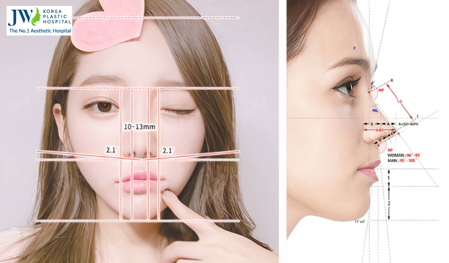 Corrective Rhinoplasty: