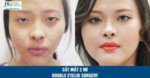 Elevate Your Look with Personalized Eyelid Surgery