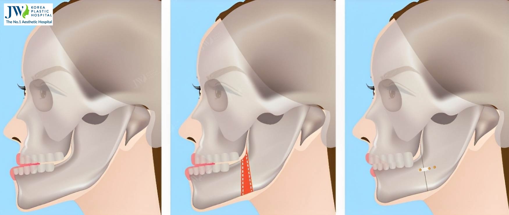 Diagnosing Malocclusions