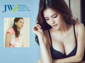 Breast augmentation with implants for voluptuous and natural-looking breasts