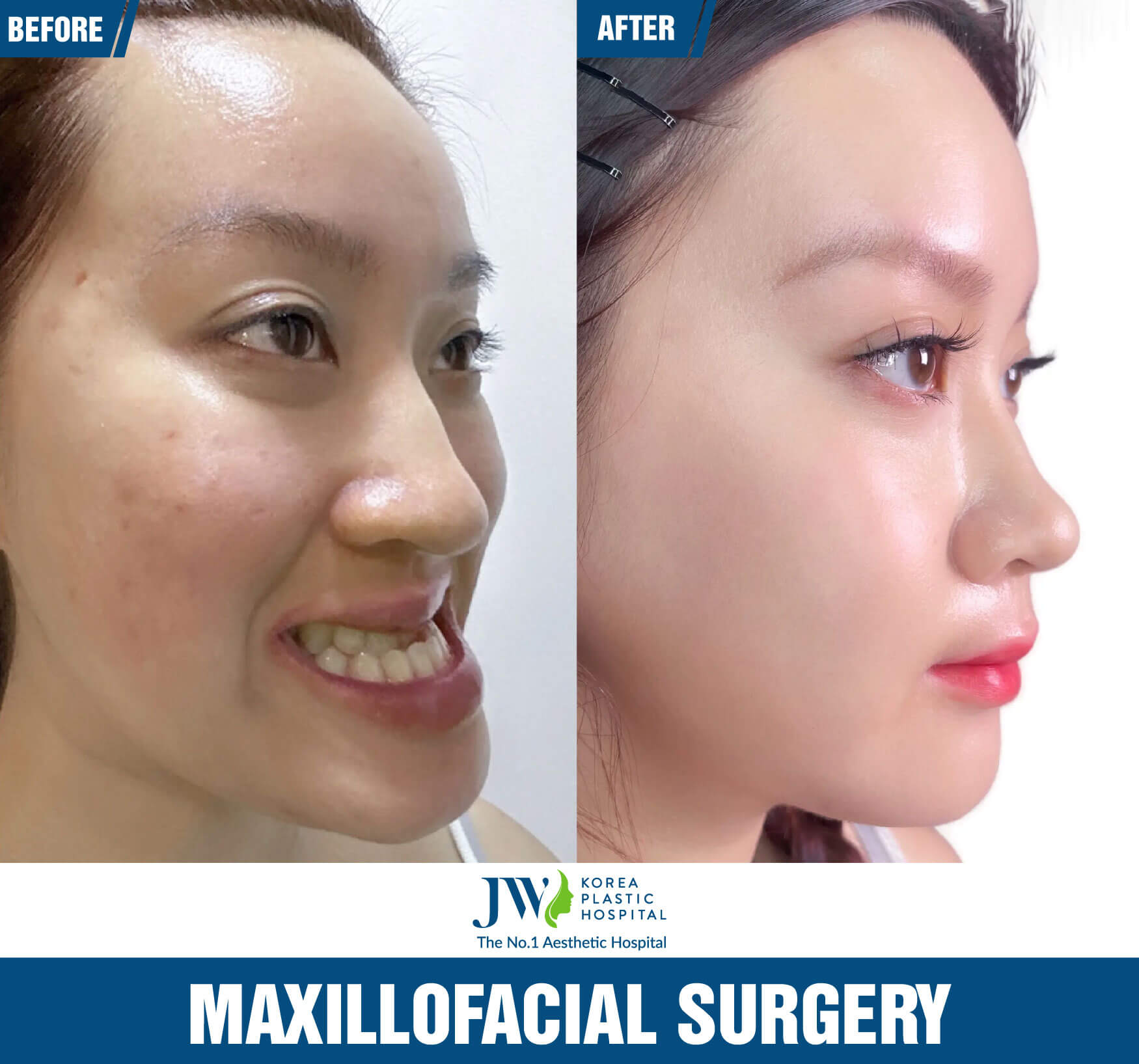 Maxillofacial Surgery 